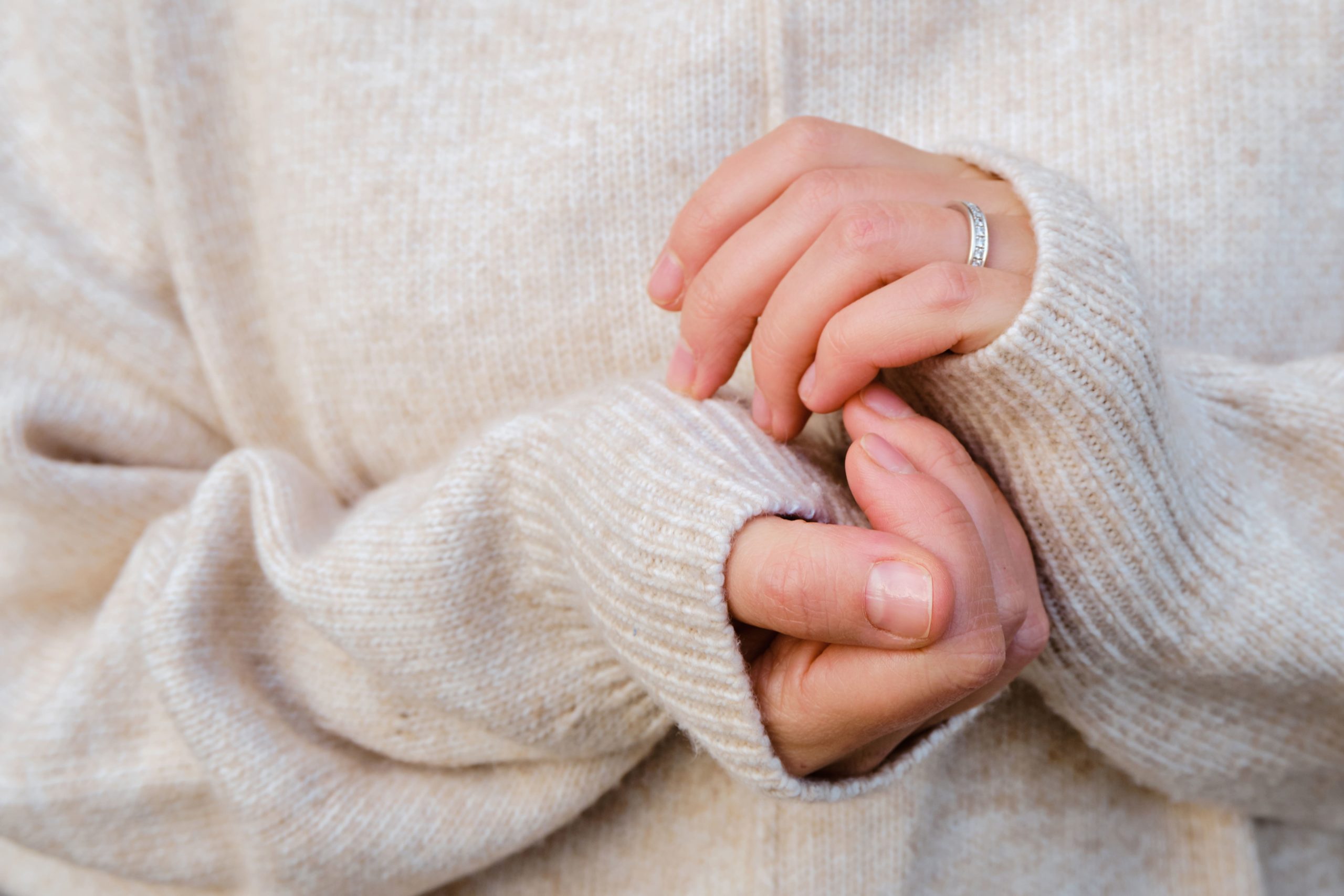 Nahaufnahme der Hände einer Frau, die einen dicken Pullover trägt - Gerade im Winter treten häufig Hautrisse an den Händen auf