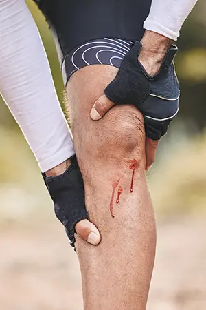 Knieverletzung beim Sport